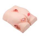 Decubitus Care